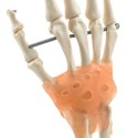 Model dłoni HeineScientific