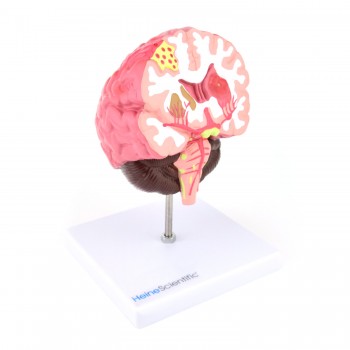 Model mózgu (18 x 10 x 9cm) HeineScientific
