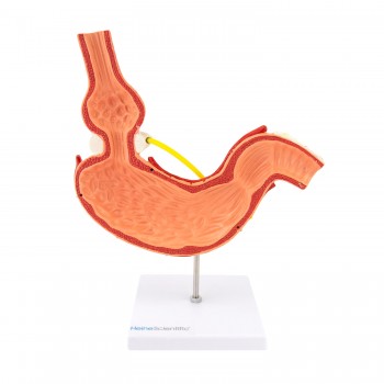 Model żołądka (26 x 20,5 x 7cm) HeineScientific